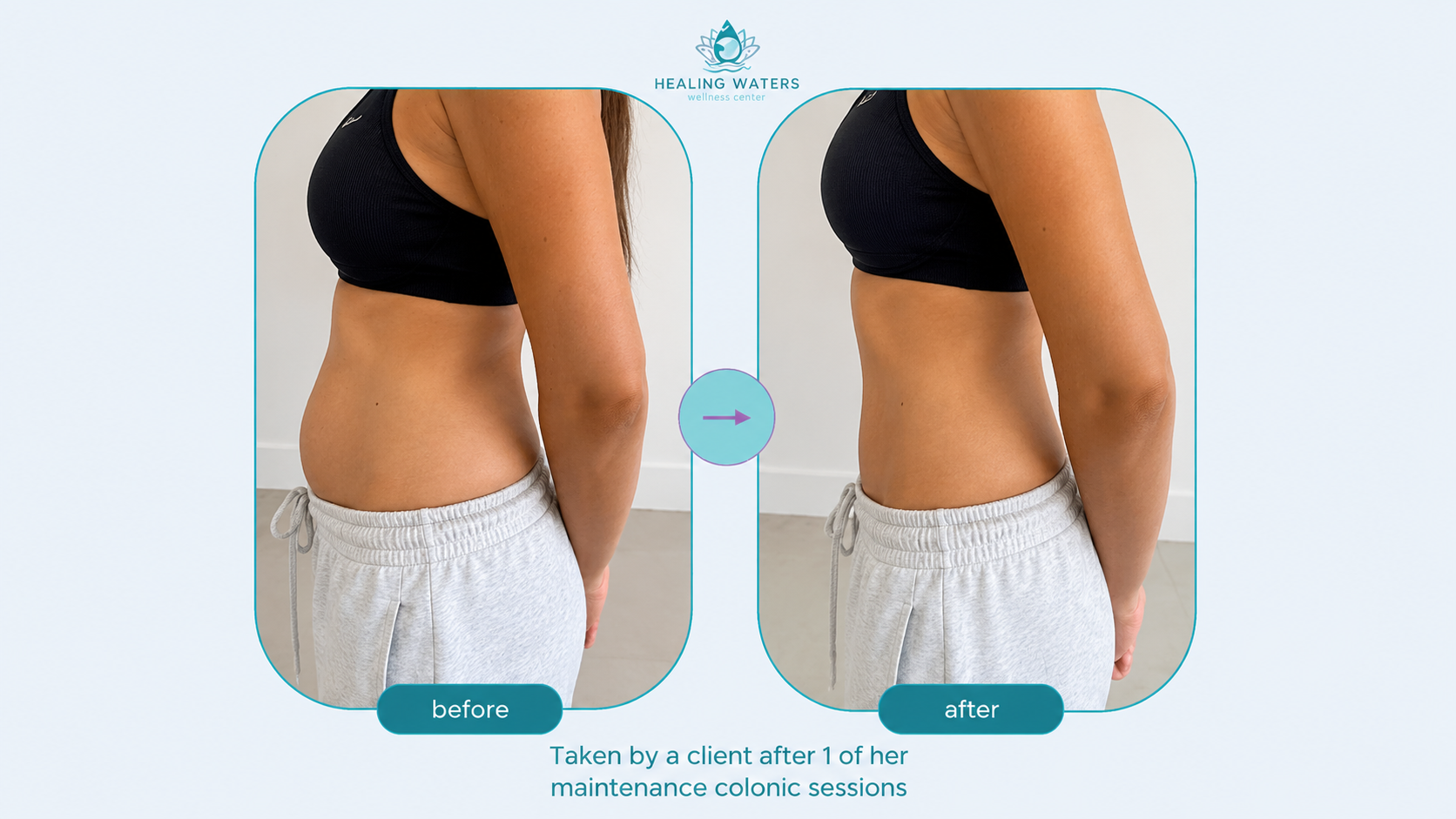 Before and after comparison of a client's midsection following a colonic session