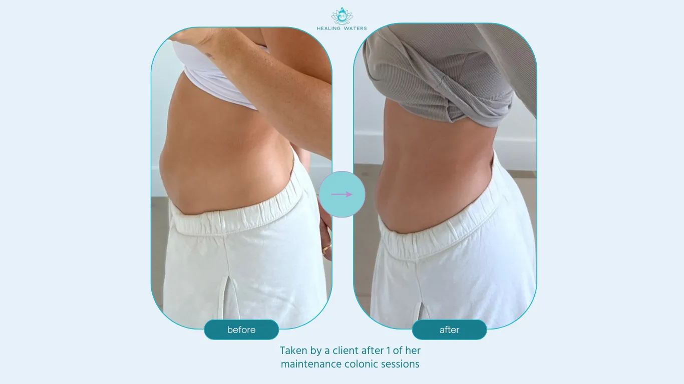 Client's midsection before and after a colon hydrotherapy session